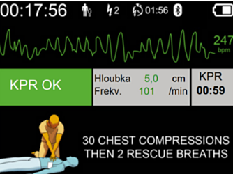 Defisign Pocket Plus EKG-analyse mulighed  - 11527